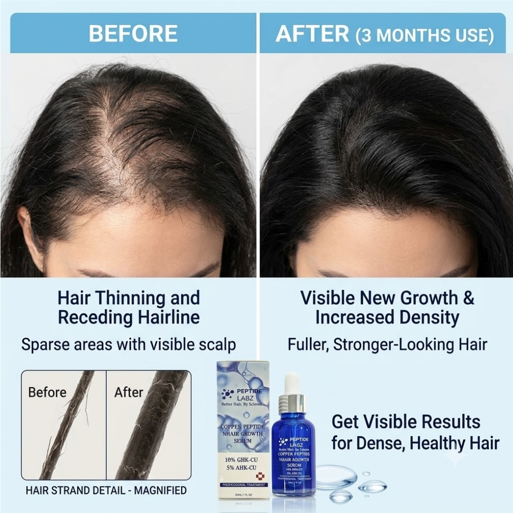 Essence de croissance des chev - Hair Care Lotion avis et prix