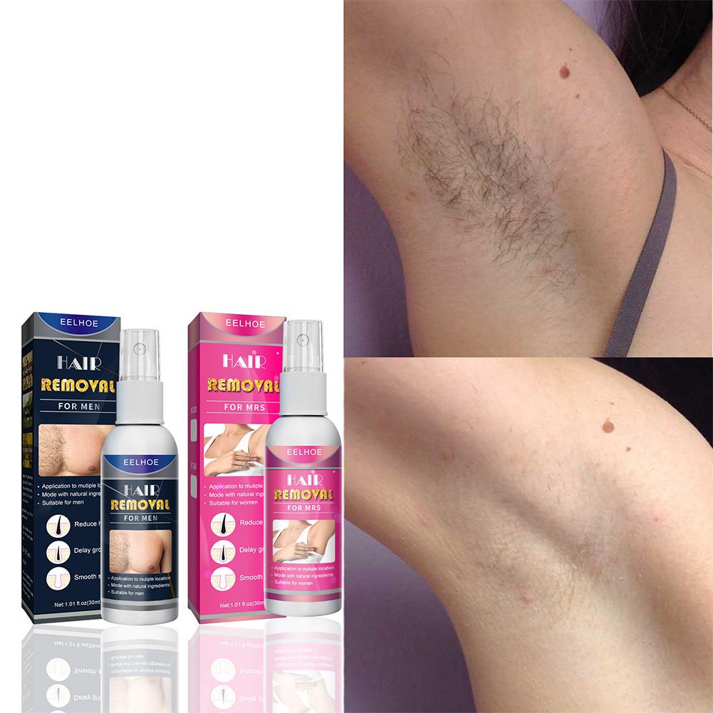 Épilateur Permanent indolore S - Hair Care Lotion avis et prix