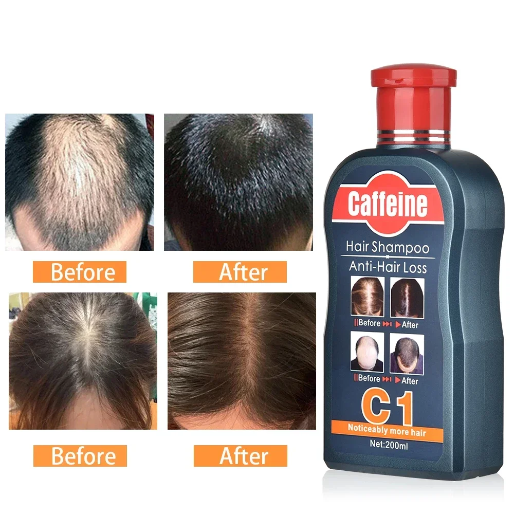 Shampooing pour la croissance  - Hair Care Korean Products avis et prix